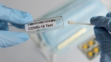 5,452 PCR cases, 8,644 positive antigen tests