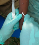 Health News Roundup: WHO reports two new monkeypox deaths, cases in new areas; Africa CDC says it has signed MOU with Pfizer for COVID pill and more