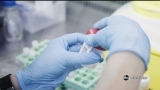 CDC reports 132 monkeypox cases in SC