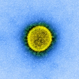 Number of COVID-19 infections missed by lateral flow tests ‘substantial enough to be of clinical importance’
