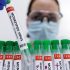 CDC warns of COVID-19 “rebound” after taking Paxlovid, but says drug still beneficial