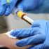 CDC Director Adopts Preference for Specific Flu Vaccines for Seniors