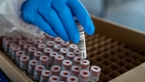 32K New Cases, 52 Deaths in Last Week; 58 Counties Now at High Alert Level – NBC Chicago