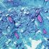A Looming Threat, Health News, ET HealthWorld