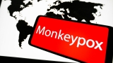 WHO declares spreading monkeypox outbreak a global health emergency