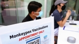 HIV positive people hospitalized with monkeypox more often, CDC says