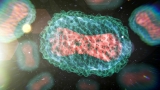 Texas reports what may be the first U.S. death from monkeypox