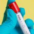 Universal Health Care Affects Childhood Vaccination Rates – Consumer Health News