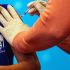 CDC widens net of monkeypox symptoms for clinicians to watch for as cases continue to rise