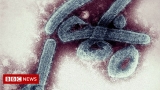 Marburg virus: Man who died in Guinea found to have disease – BBC News