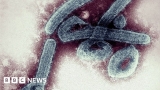 Ghana confirms first cases of deadly Marburg virus – BBC