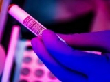 Health News Roundup: Singapore reports 935 new COVID-19 cases, highest since April last year; Biden adds measles to list of diseases that could require quarantine and more