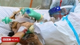 Covid: Romania's health system torn apart by pandemic – BBC News