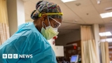The puzzle of America’s record Covid hospital rate