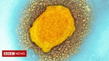 Monkeypox: Time to worry or one to ignore? – BBC