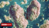 Monkeypox: Cases detected in three more countries for first time – BBC