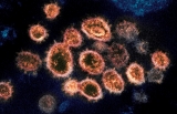 Bedford County hits ‘high’ level of COVID spread, 3 others ‘substantial’, masks recommended by CDC