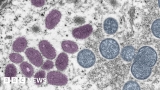 Monkeypox: First deaths outside Africa in Brazil and Spain – BBC