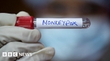 Monkeypox: Kerala confirms India's first death and isolates 20 contacts – BBC