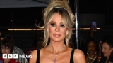 I'm A Celebrity: Olivia Attwood withdraws on medical grounds – BBC