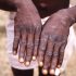 Most of Hawaiʻi is now under the CDC’s ‘high’ COVID-19 community level