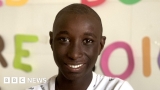 Changing the lives of Senegalese people disabled by clubfoot – BBC
