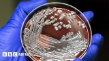 Superbug fight 'needs farmers to reduce antibiotic use' – BBC