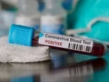 Health News Roundup: U.S. health secretary tests positive for COVID on trip to Berlin; COVID is rising in the Americas, virus ‘not going away anytime soon’ -PAHO and more