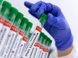 Health News Roundup: Biden administration to rejig HHS to boost pandemic response – The Washington Post; WHO reports 14,000 cases of monkeypox globally, five deaths in Africa and more