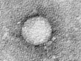 Hepatitis cases in children draw concern in US, CDC says Covid not a factor