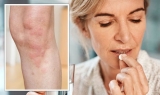 Coronavirus news update: Penicillin allergy could worsen symptoms
