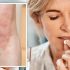 Breakthrough Infections and the Delta Variant: What to Know