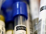 Health News Roundup: Spain’s COVID-19 cases continue to rise; Indonesia to boost social, health spending amid virus battleand more