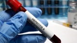 Maine CDC warns of possible hepatitis A exposure at Skowhegan Walmart – WGME