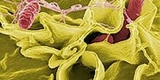 CDC: Salmonella Outbreak Linked to Jule’s Cashew Brie​ – Consumer Health News