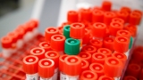 WHO recommends Roche, Sanofi drugs for COVID-19 to cut death risk