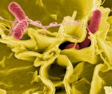 Salmonella Outbreak Has Left 279 Ill, 26 Hospitalized In 29 States
