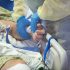 COVID-19: Projections On Cases, Deaths In Weeks Ahead Released By CDC; What To Expect In NY