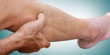 Peripheral Neuropathy Observed in Patients With ‘Long COVID’ – Consumer Health News