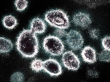 Pakistan reports 46 fresh Coronavirus cases and three more deaths