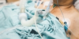 WHO Says Pandemic Death Total Far Higher Than Reported in Many Countries – Consumer Health News
