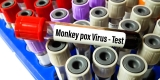 Monkeypox Poses Challenges, Even in High-Income Countries – Consumer Health News