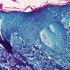 CDC/ATSDR welcomes public comment on draft of Cancer Cluster Guidelines