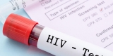 HIV Testing Plummeted During Pandemic – Consumer Health News