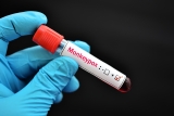 US stumbles in monkeypox response