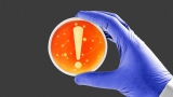 Brain-eating amoebas are northbound; suspected in Iowa