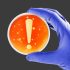 Low Risk Seen for Health Care-Linked Monkeypox Transmission – Consumer Health News