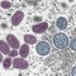 What’s behind COVID reinfections?