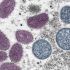 Omicron BA.5 makes up 82% of COVID variants in U.S., CDC says