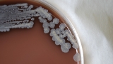 Potentially deadly bacteria found in U.S. for first time